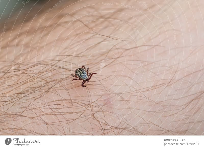 Zecke läuft über menschliche Haut Klima Klimawandel Gras Garten Park Wiese Behaarung Holzbock krabbeln bedrohlich Medikament Arzt Impfung FSME Borreliose Sommer