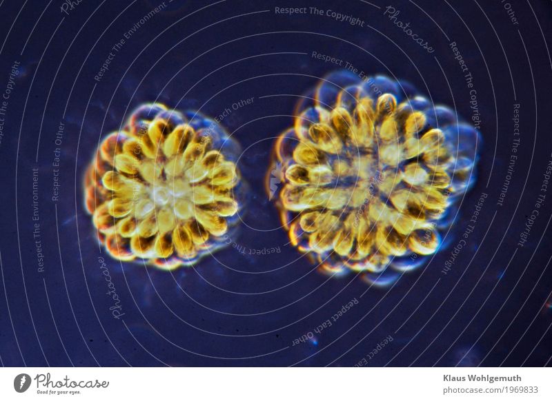 400x Umwelt Natur Pflanze Wasser Algen Rosetten- Goldkugel Teich Schwimmen & Baden blau gelb gold grün Mikroskop Mikrofotografie Geißelzellen chlorphyll