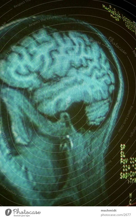 intoyourbrain Gehirn u. Nerven Mensch Kopf Haarschnitt Radiologie