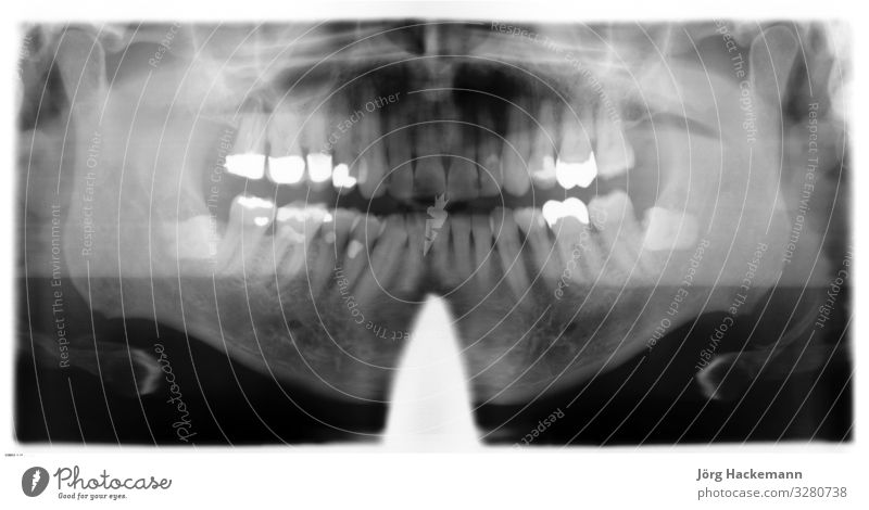 Röntgendarstellung schön Behandlung Medikament Arzt Büro Mensch Frau Erwachsene Zähne Hand Handschuhe Lächeln Sauberkeit weiß Pflege Diagnostik Klinik dental