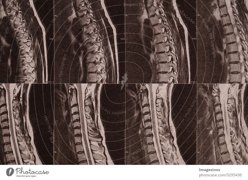 Bandscheiben Labor Arzt Medizintechnik Medizinisches Instrument Röntgenbild Krankenhaus Industrie Handwerk Röntgenstrahlen CT MRT Radiologie