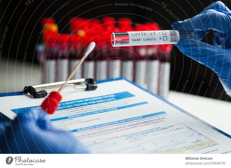 rt-PCR COVID-19 Viruserkrankung diagnostischer Test, Labortechniker mit blauen Schutzhandschuhen, der ein Reagenzglas mit einem Tupferstab hält, Tupferproben-Ausrüstungssatz & CDC-Formular mit Richtlinien zur Einreichung von Proben