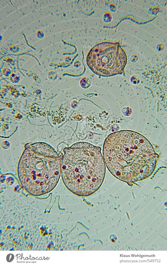 Glockentierchen im Durchlicht bei ca. 400x Vergrößerung , leicht angefärbt, man erkennt die Vakuolen, in der Umgebung sind Ketten von stäbchenförmigen Bakterien erkennbar.