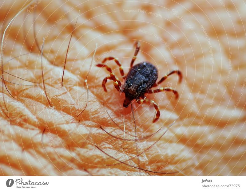 an tick Gliederfüßer Schiffsbug Nahaufnahme Makroaufnahme Mensch Sommer Terror Tick arachinoid arachnid Arme arthropod bite blood bloodsucker carrier close