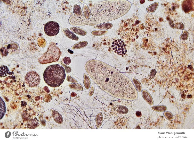 Pantoffelhelden Umwelt Natur Pantoffeltierchen Wimperntierchen Mikorobe Bakterien Tiergruppe Schwimmen & Baden blau braun gelb grau rot schwarz Mikrobiologie