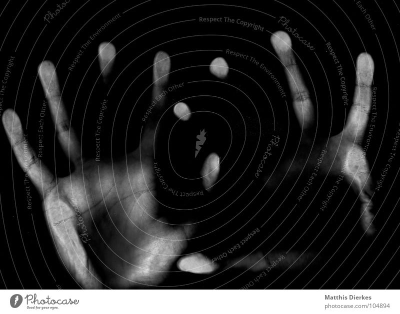 X-RAYS X-rays Scanner Comprehend Broken To break (something) Accident Sporting accident Diagnosis Railroad tracks Connectedness Dangerous Hand Fingers Thumb