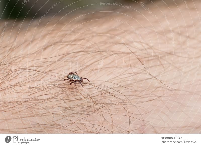 Tick runs over human skin Nature Garden Park Meadow Hair Insect TBE early summer meningitis early summer meninggoencephalitis Lyme disease Crawl Immunization