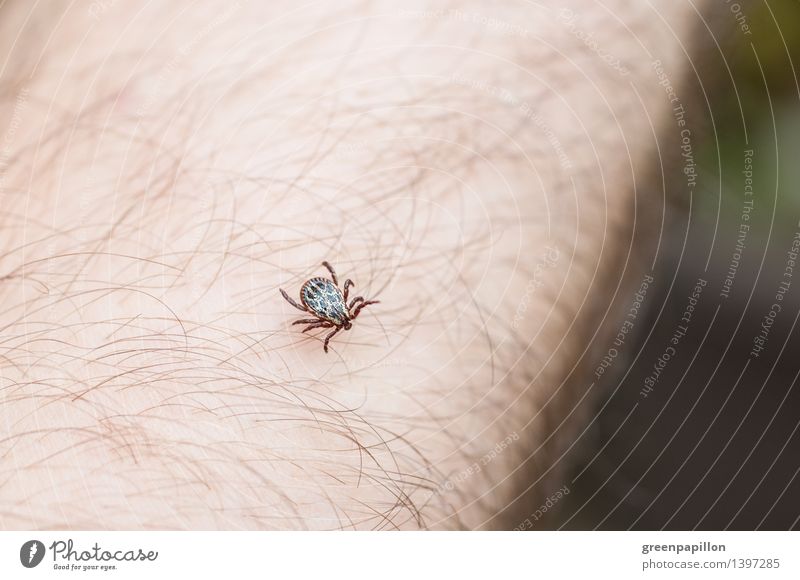 Tick runs over human skin Healthy Skin Hair and hairstyles Animal Wood tick Crawl Disgust early summer meningitis TBE Lyme disease Parasite Parasitic