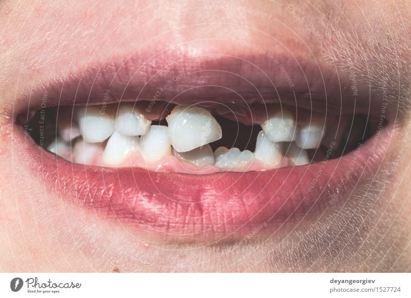 Child shows missing teeth. Happy Face Boy (child) Infancy Mouth Teeth Smiling Cute White milk Lost First kid loss background care Expression front Fairy Dental