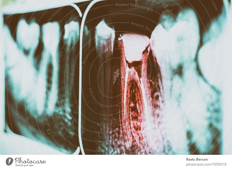 Pain Of Tooth Decay On Teeth X-Ray Personal hygiene Healthy Health care Medical treatment Medication Human being 18 - 30 years Youth (Young adults) Adults