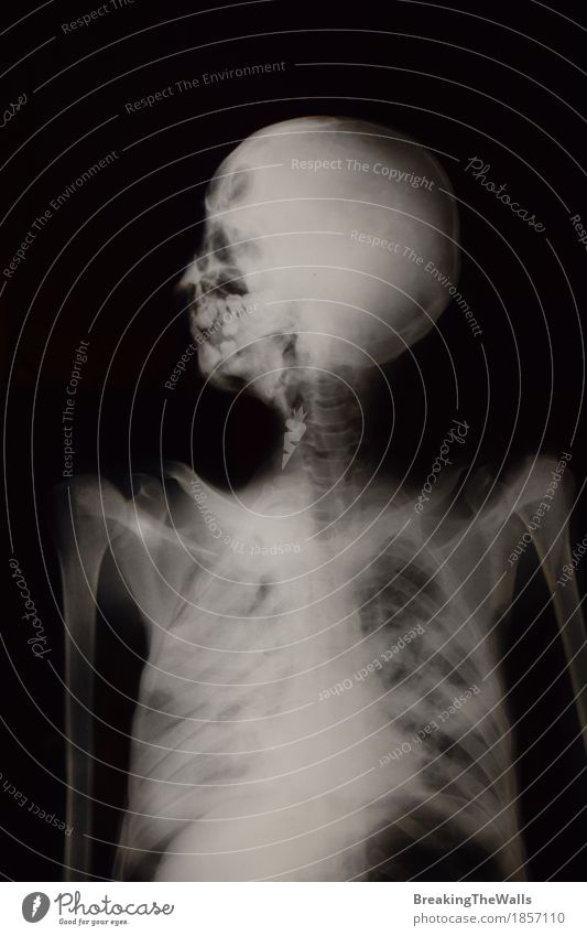 Human skeleton X-ray examination roentgenogram Healthy Health care Medical treatment Medication Science & Research Hospital Technology Body Head Chest 1