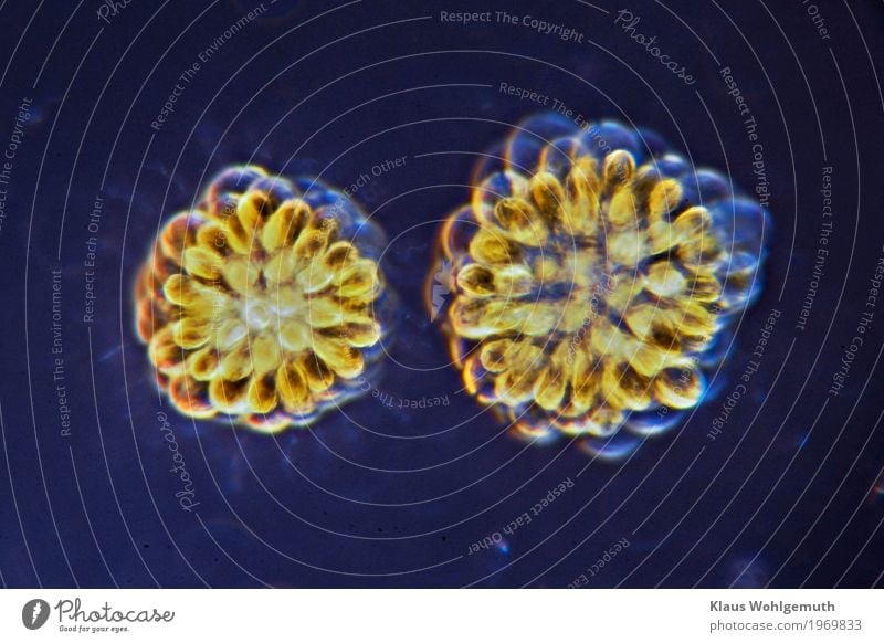 400x Environment Nature Plant Water Algae Rosette Gold Ball Pond Swimming & Bathing Blue Yellow Green Microscope Photomicrograph scourge cells chlorine phyllide