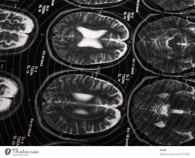 Nuclear Spin Series No.1 Brain and nervous system Electrical equipment Technology Death's head fluoroscopy Head Photography Magnetic resonance imaging Diagnosis