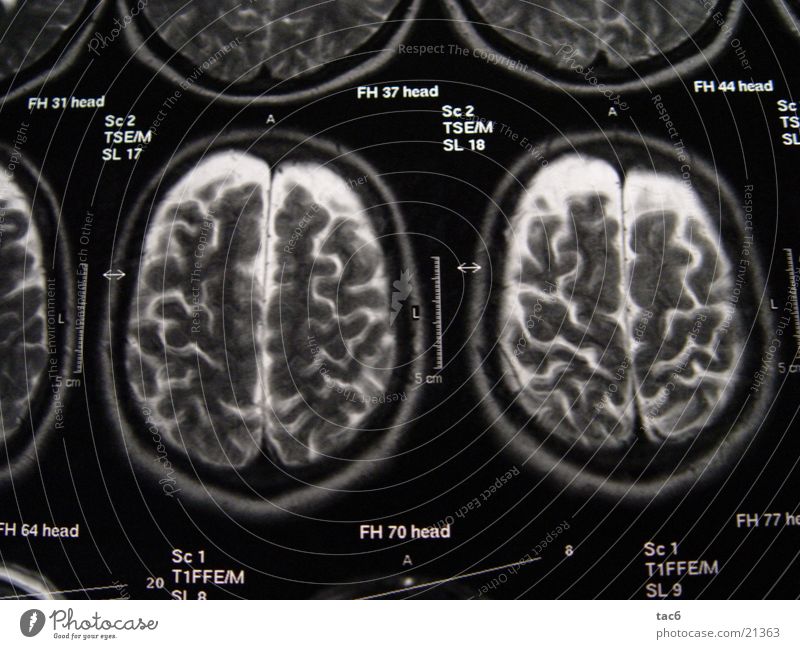 Nuclear Spin Series No.4 Brain and nervous system Electrical equipment Technology Death's head fluoroscopy Head Photography Magnetic resonance imaging Diagnosis