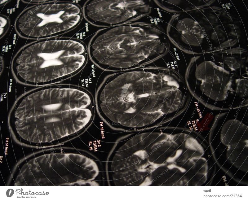 Nuclear Spin Series No.2 Brain and nervous system Electrical equipment Technology Death's head fluoroscopy Head Photography Magnetic resonance imaging Diagnosis