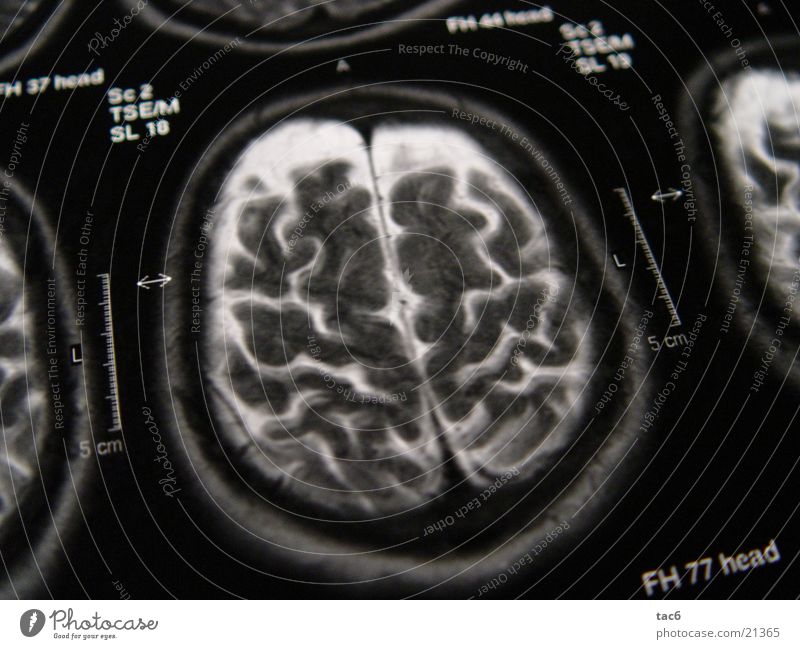 Nuclear Spin Series No.3 Brain and nervous system Electrical equipment Technology Death's head fluoroscopy Head Photography Magnetic resonance imaging Diagnosis