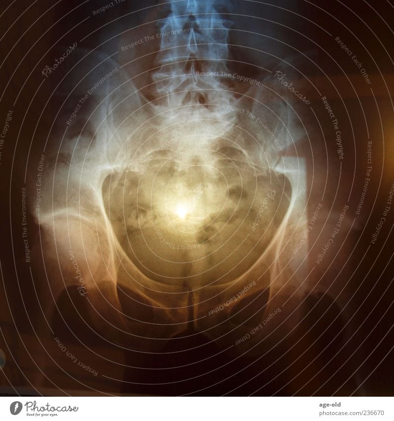 X-ray on sunset Man Adults Hip Blue Brown Yellow Black Bizarre X-ray photograph Sunlight Sunset Radiology Colour photo Exterior shot Experimental Evening