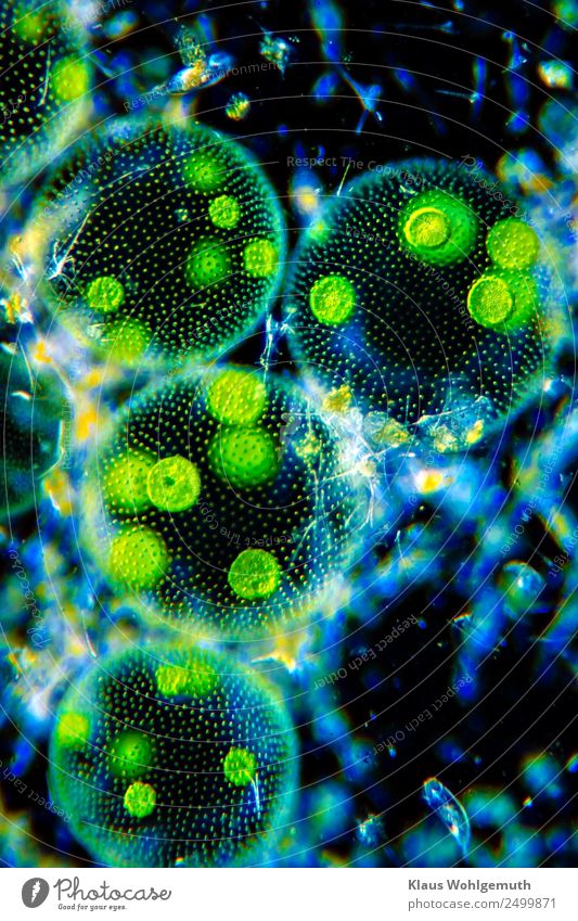 microcosm Environment Plant Summer Exotic Algae Volvox Pond Swimming & Bathing Elegant Round Beautiful Blue Yellow Green Black Photomicrograph Microscope