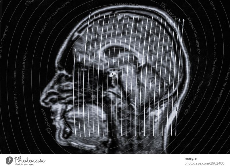 UT Kassel | Dickkopf Health care Technology Science & Research High-tech Human being Masculine Feminine Androgynous Woman Adults Man Face Nose 1 Black White