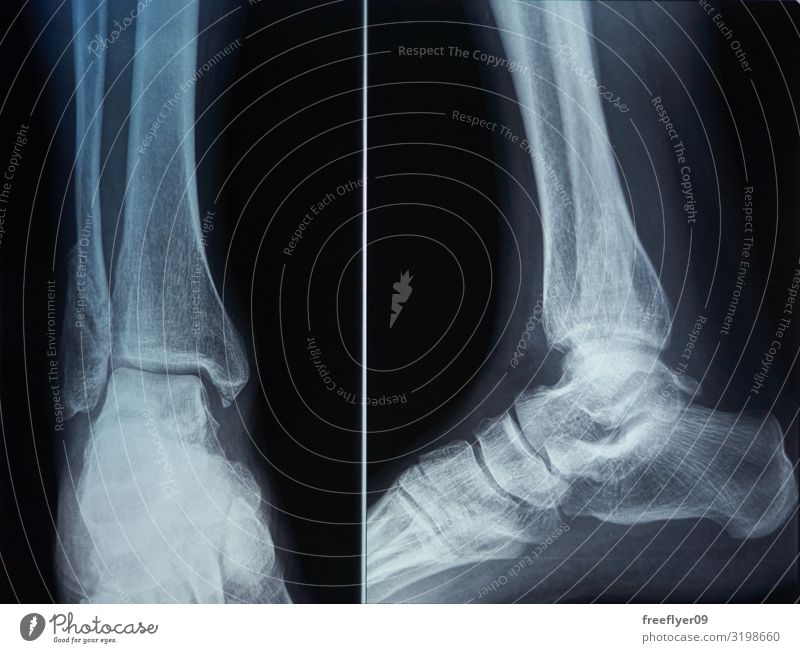 Bone scan of a foot Body Health care Care of the elderly Illness Medication Wellness Science & Research Examinations and Tests Doctor Hospital Technology