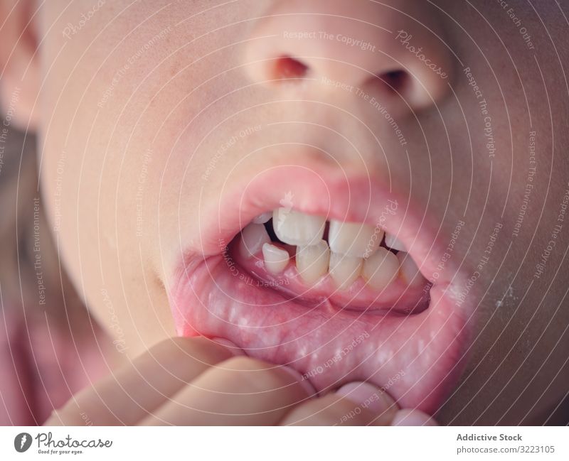 Open mouth of kid full of permanent and deciduous teeth tooth childhood oral milk dental smile open face showing expression orthodontic procedure confident