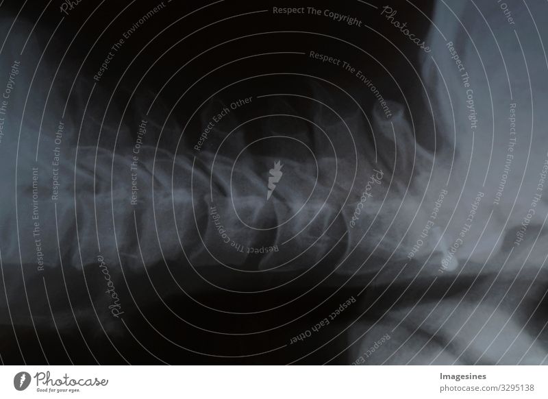 Slipped disc X-ray photograph X-rays X-ray vision Doctor Radiation Hospital Illness Health care "magnetic resonance picture, human spine Spinal column side view