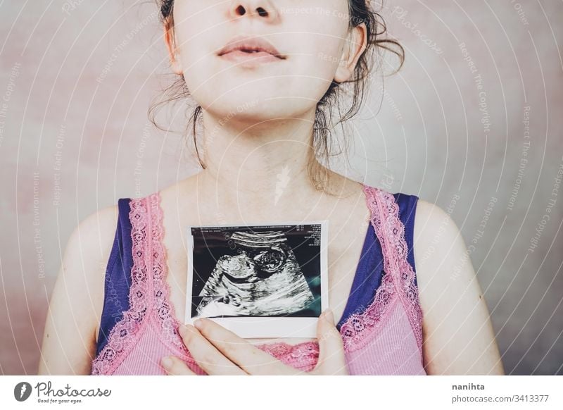 Woman holding the ultrasound of her baby pregnant pregnancy mom family second quarter trimester month 20 weeks health medical treatment equipment shot close