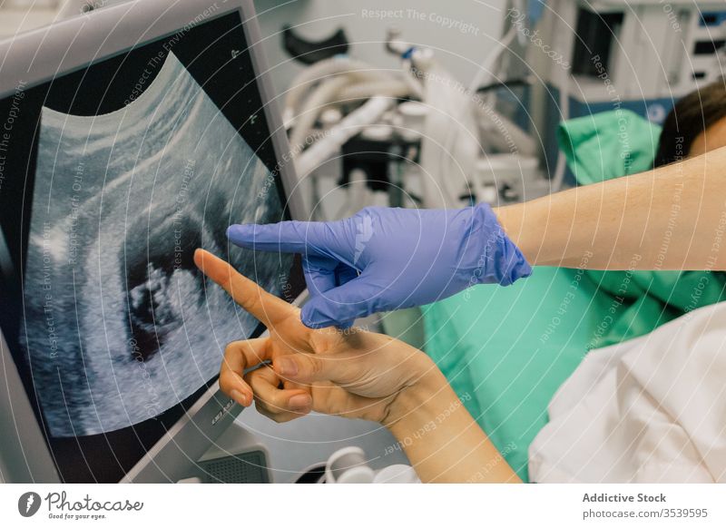 Crop gynecologist showing anonymous female patient embryo at computer screen monitor medical equipment clinic ultrasound test doctor hand body part fetus