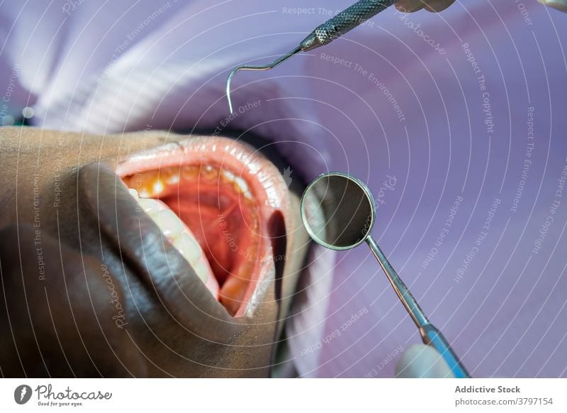 Crop dentist examining teeth of patient in clinic dental mirror examine doctor light oral stomatology procedure ethnic modern healthy specialist treat work