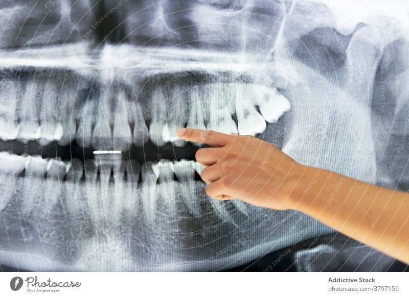 Ethnic female dentist in medical room with X ray x ray dental clinic doctor woman dentistry teeth patient jaw information health care specialist lady examine