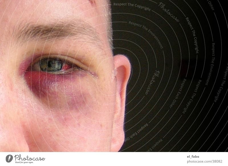 multicultural Argument Human being Black eye Violet plants brawl ...