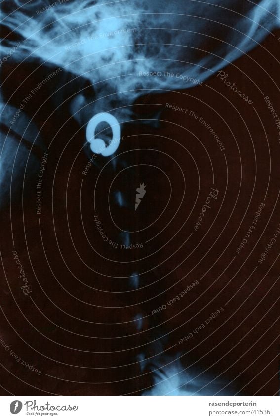 uups, my earring... Piercing X-ray photograph Radiation Spinal column Science & Research Earring Head Radiology