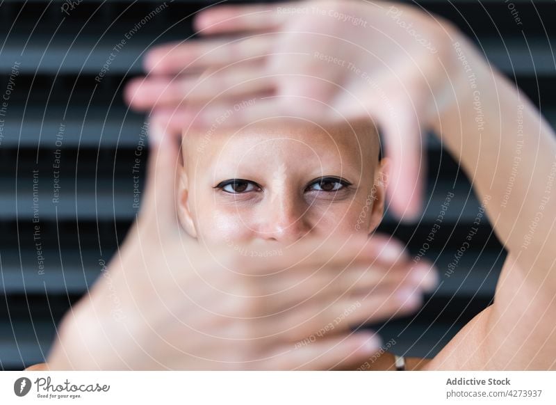 Positive young bald woman showing camera and smiling gesture smile positive alopecia trendy individuality delight style glad street female outfit hairless joy