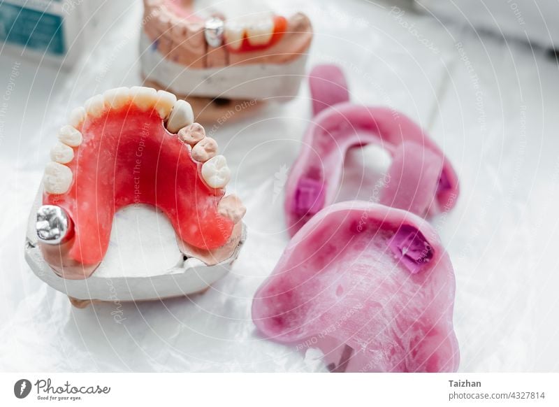 dental gypsum models of upper jaw, dental concept tooth dentist dentistry laboratory medical medicine denture plaster prosthesis equipment human mouth oral