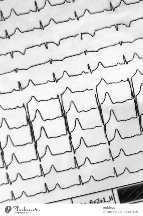 ECG display of a Heart rate or pulse wave measurement equipment in a hospital graph heart cardiology electrocardiogram ecg care diagnosis cardiac beat test