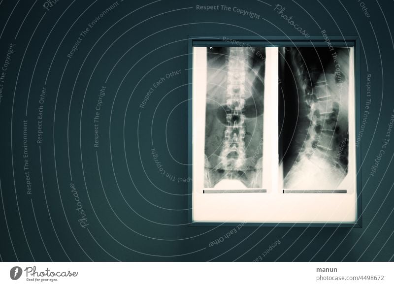 X-ray image of the spine Spinal column X-ray photograph Radiology Diagnosis Doctor Health care Healthy Skeleton Technology clinic Illness Bone med Hospital