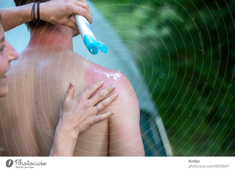 A laughing young woman creams a friend with suntan lotion a sunburn Sunburn sun protection Skin Put on cream Suntan lotion Protection Summer Young woman