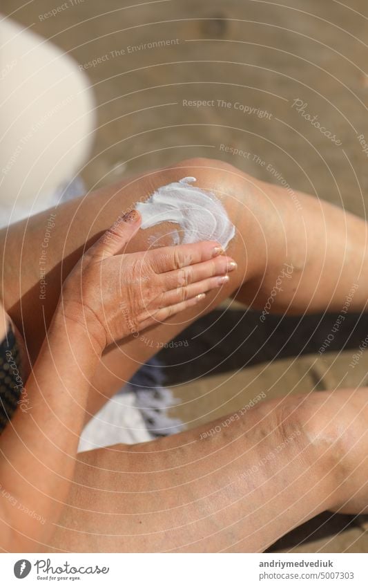 overweight woman applying sunscreen lotion on her legs with varicose veins, close up detail. vacation on sea beach. cosmetic beautiful beauty body care