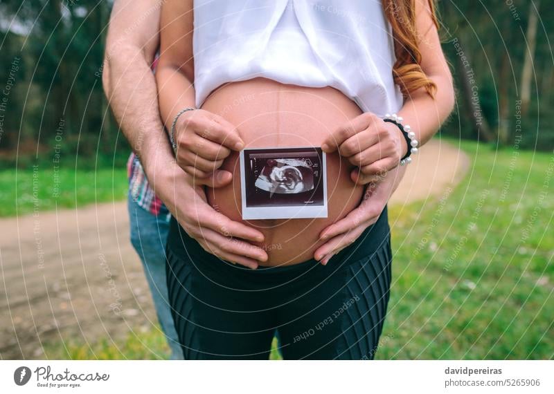 Female pregnant showing ultrasound scan of baby while her partner holding her belly unrecognizable woman female couple ultrasonic echography pregnancy tummy