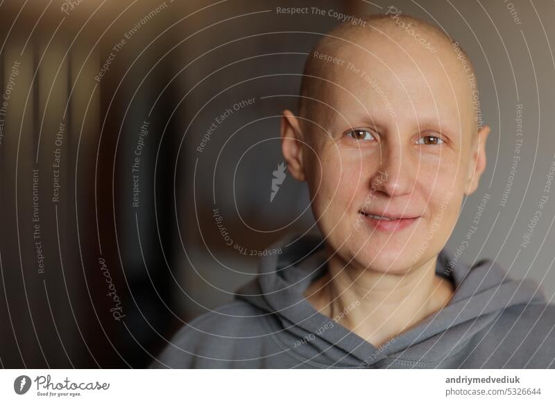 Smiling hairless young female patient struggle with oncology look at camera at home. Bald cancer sick woman after chemotherapy lost her eyebrows and eyelashes feel optimistic of recovery remission