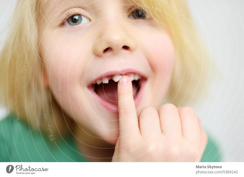 Portrait of boy shaking wobbly milk tooth in open mouth before it changes to the molar. Stages of growing up a child. Health care and dental hygiene for baby.