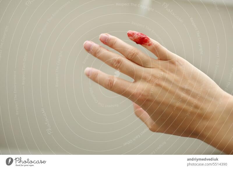 Female hand with red blood, little finger is bleeding profusely. Woman injured her little finger at home with knife or other sharp object. Bleeding wound and body injury result. Domestic accident.