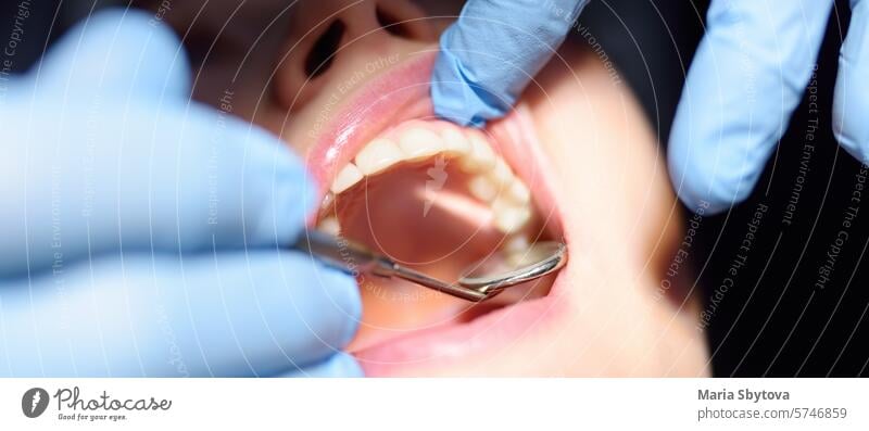 Dentist treats young woman teeth in hospital. Doctor Practitioner examines patient before orthodontists or prosthetics treatment at modern medical center. Close up view of teeth and hands. Banner