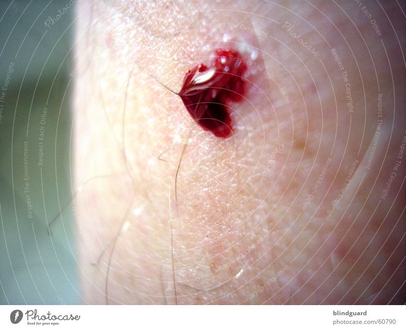 My Blood For You ... Red Scratch mark Macro (Extreme close-up) Close-up Arm Hair and hairstyles pain Patch Drops of water drop Stab wound blood poisoning Skin