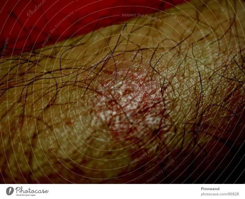 hairy scenery Burn Wound Red Human being Scar Macro (Extreme close-up) Hair